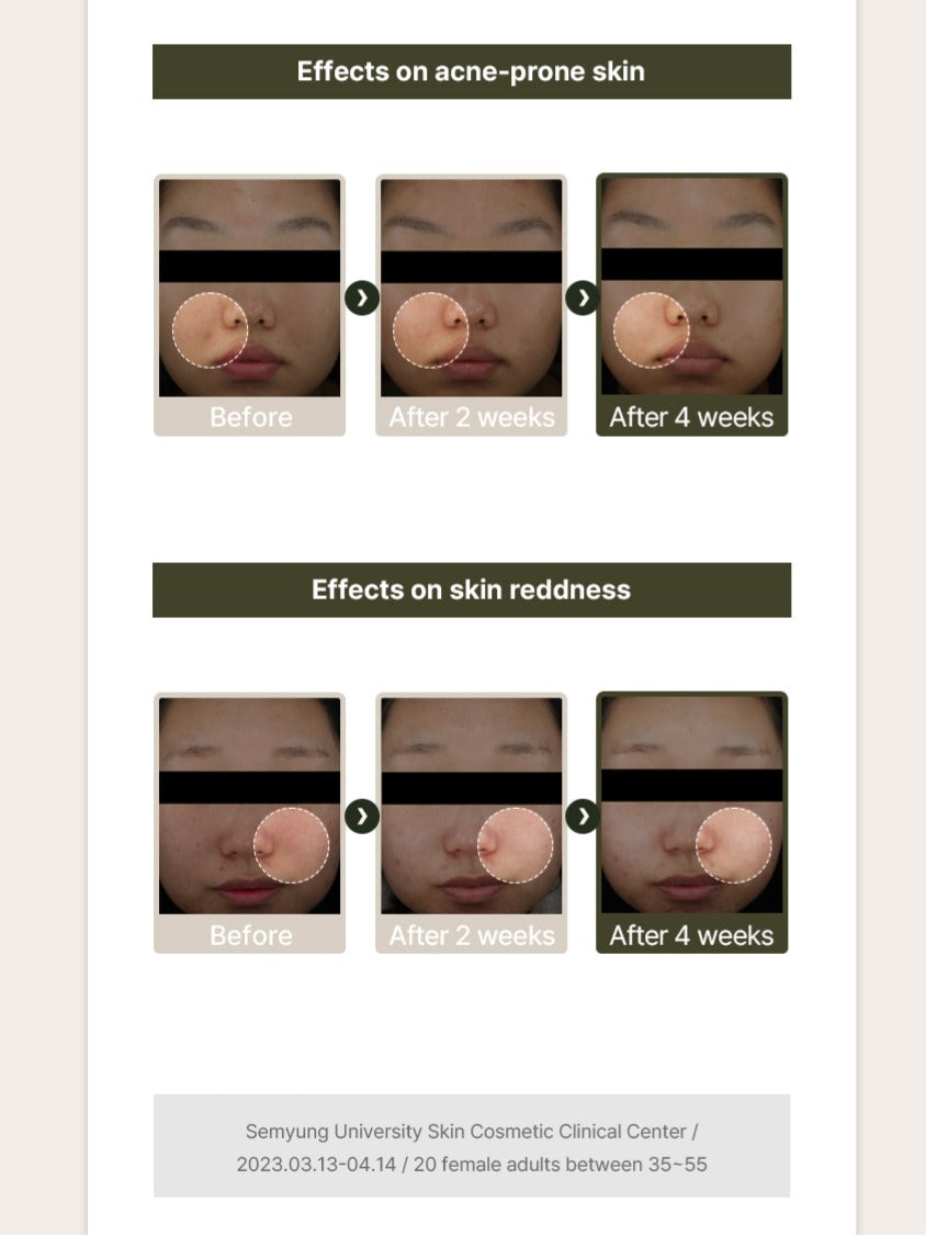 d.nuvo Fresh Ceramided™ Calming Ampoule –  for Acne-Prone & Aging Skin | Anti-Wrinkle (30ml)