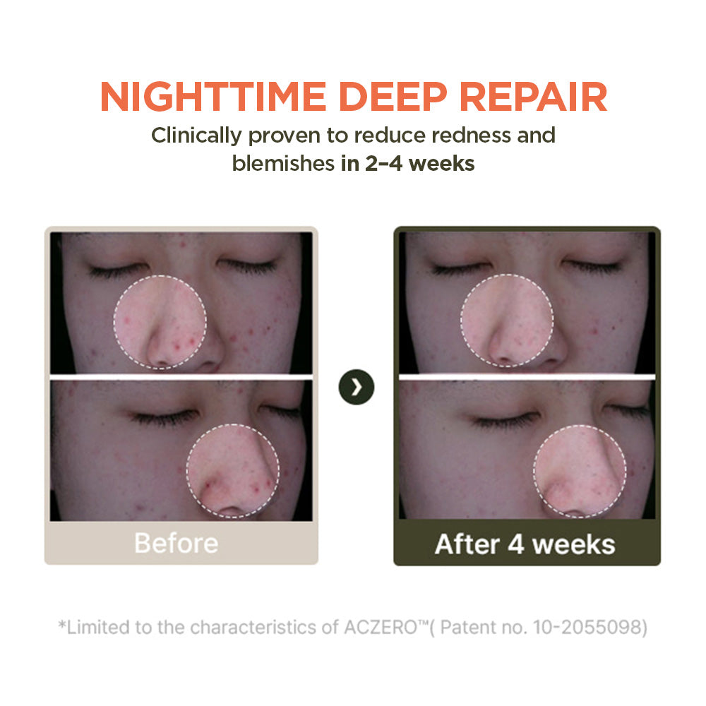 Total Skin Reset Kit (Full Bundle)