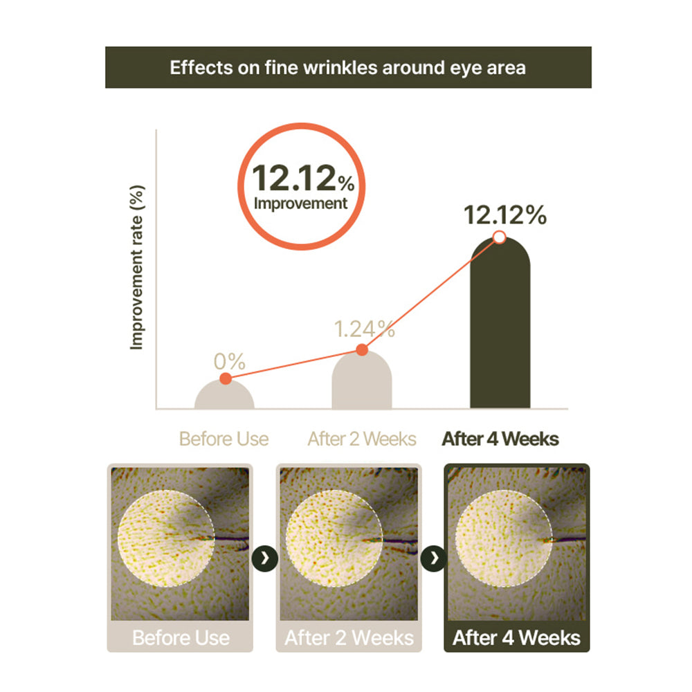 d.nuvo Fresh Ceramided™ Eye Cream – Wrinkles Fade in 2 Weeks, Deep Hydration  (35ml)