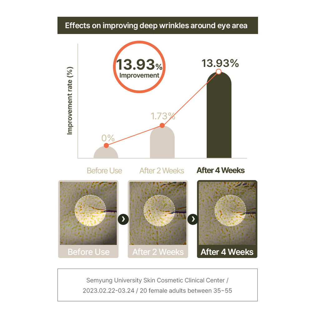 d.nuvo Fresh Ceramided™ Eye Cream – Wrinkles Fade in 2 Weeks, Deep Hydration  (35ml)